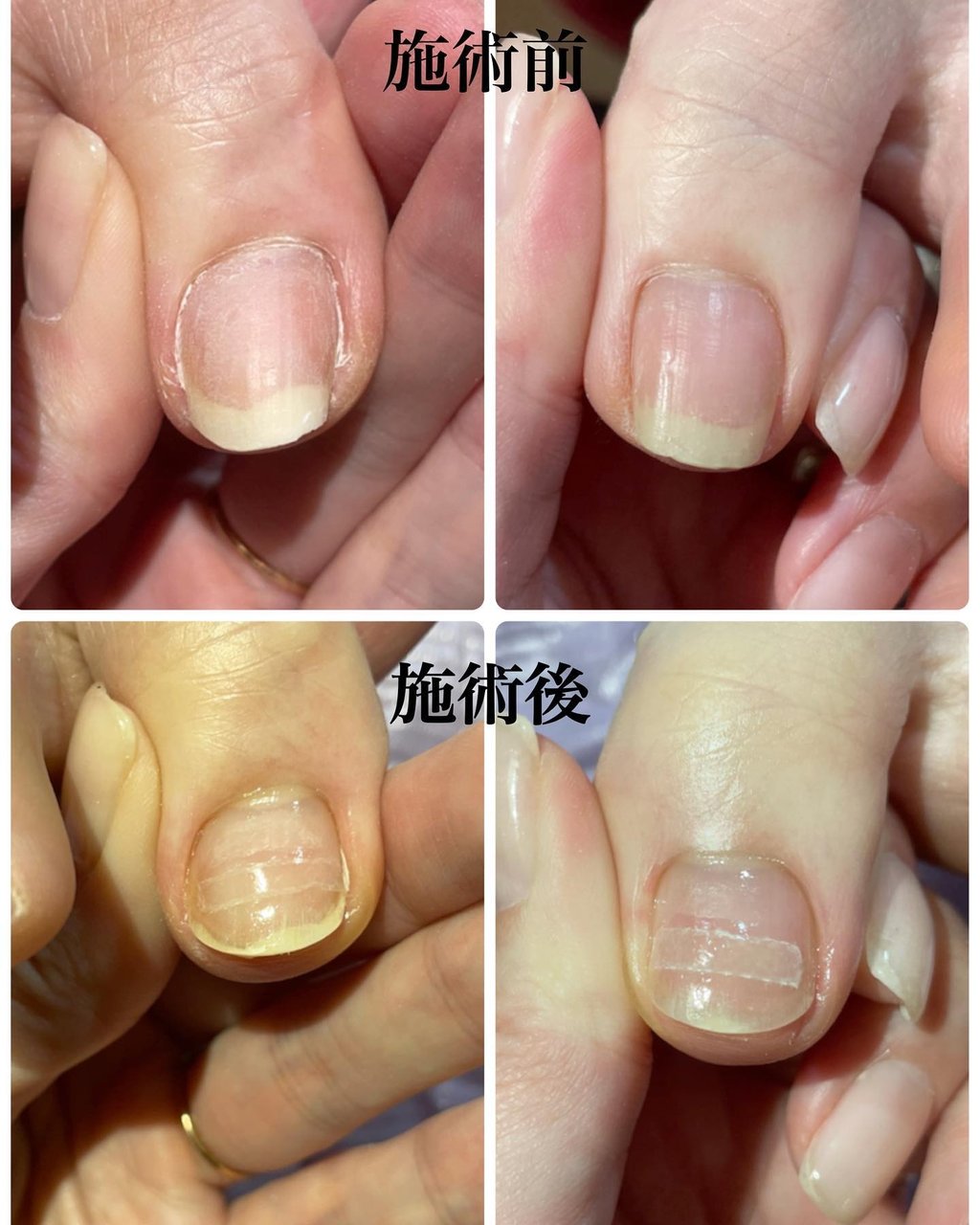 フット Prunelleのネイルデザイン No ネイルブック
