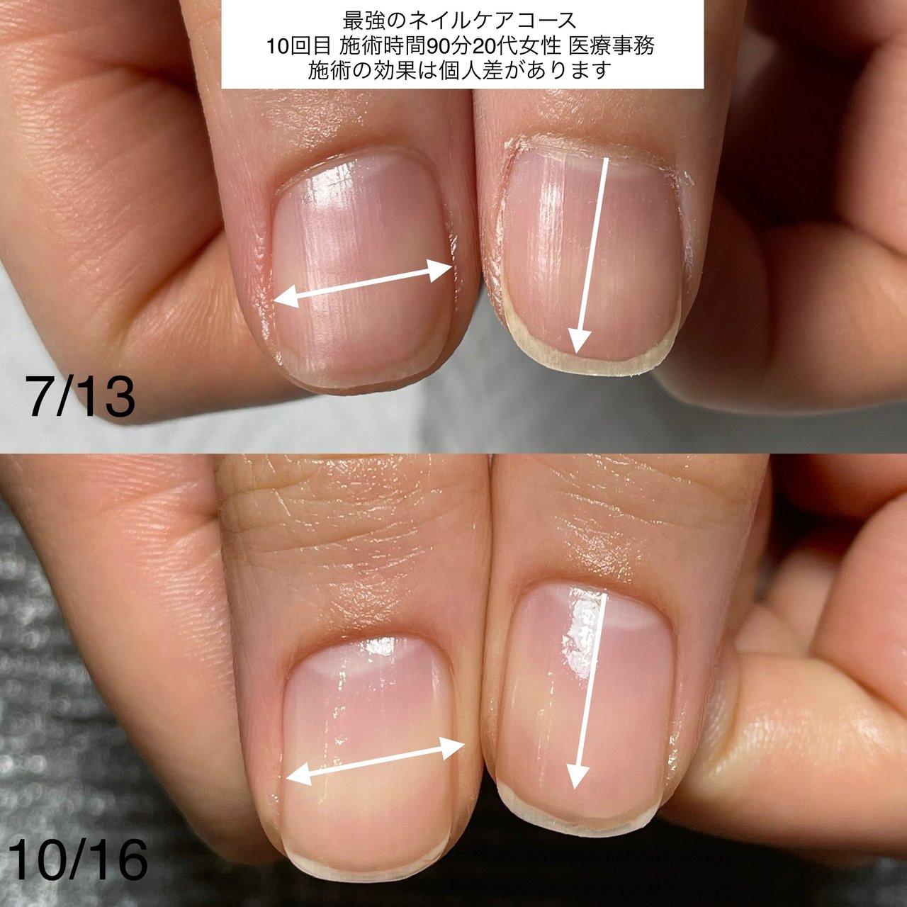 オールシーズン オフィス ブライダル ハンド マニキュア ネイルサロンティンブレのネイルデザイン No ネイルブック
