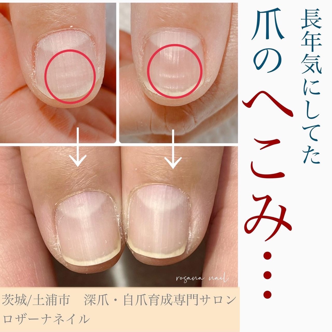 医療過誤 週間 脈拍 爪 凹む 火曜日 たくさん ジャグリング