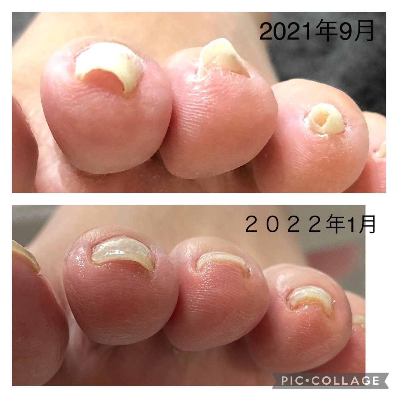 Nail Ism ネイルイズムのネイルデザイン No ネイルブック