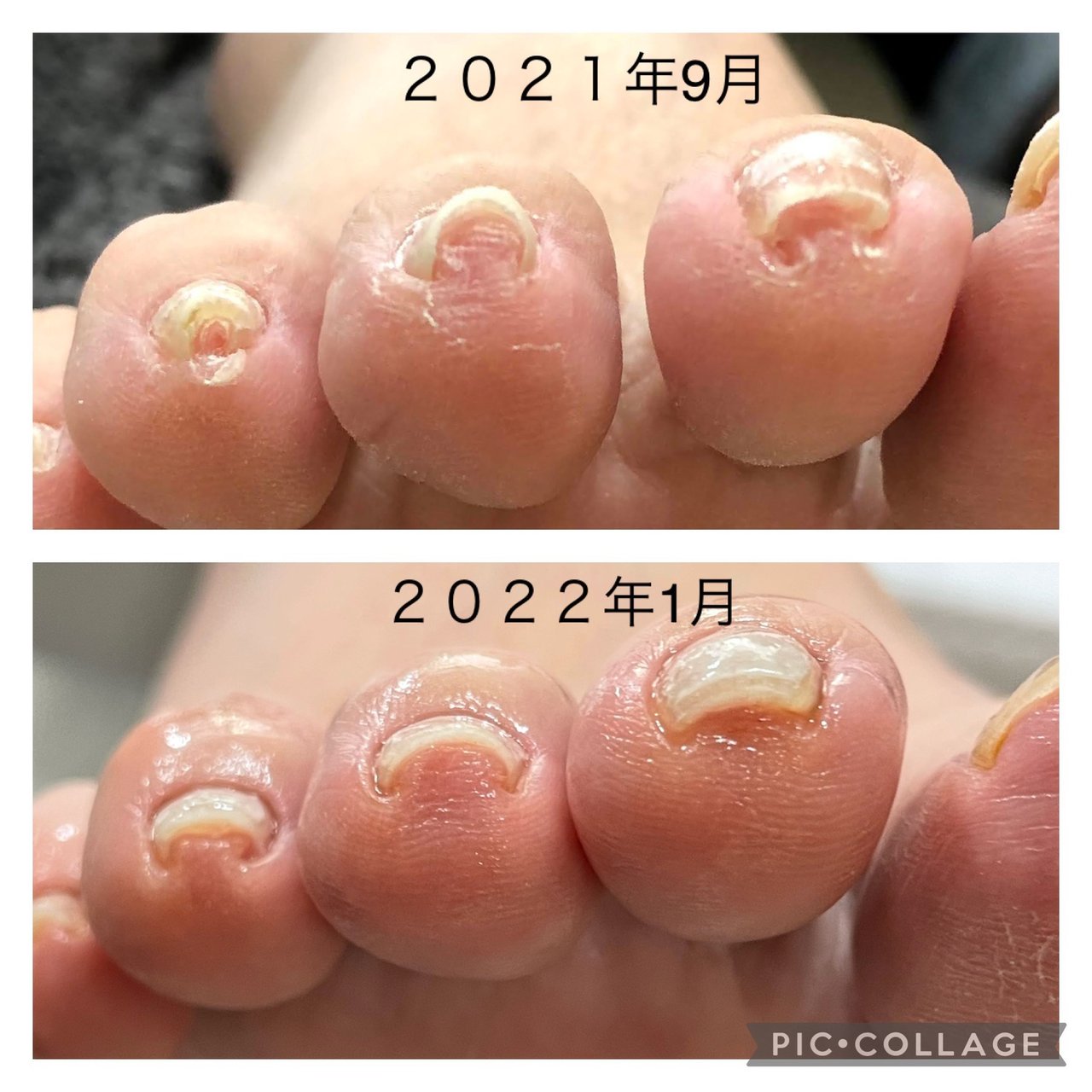 Nail Ism ネイルイズムのネイルデザイン No ネイルブック