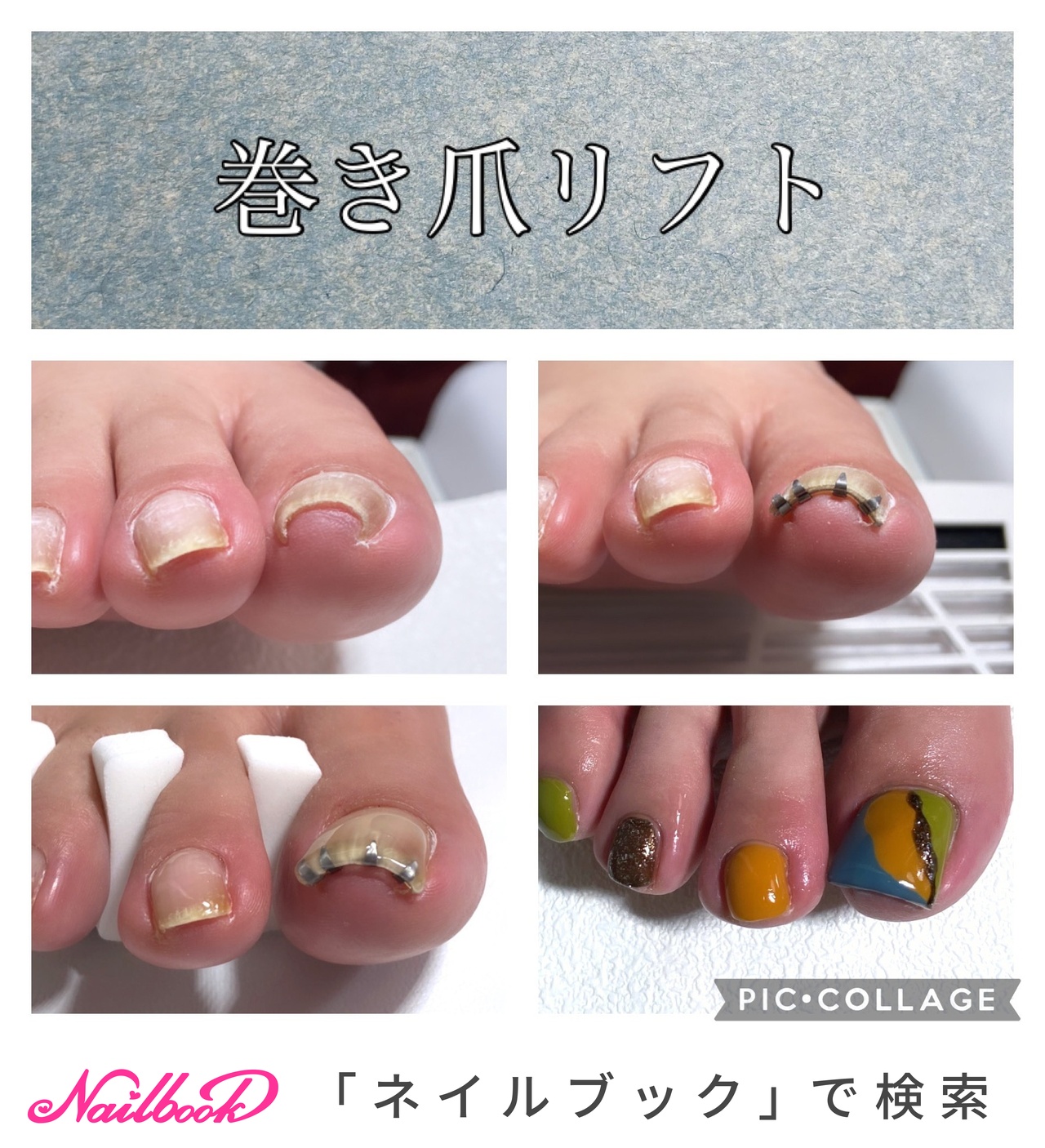 まきづめリフトプロのネイルデザイン ネイルブック