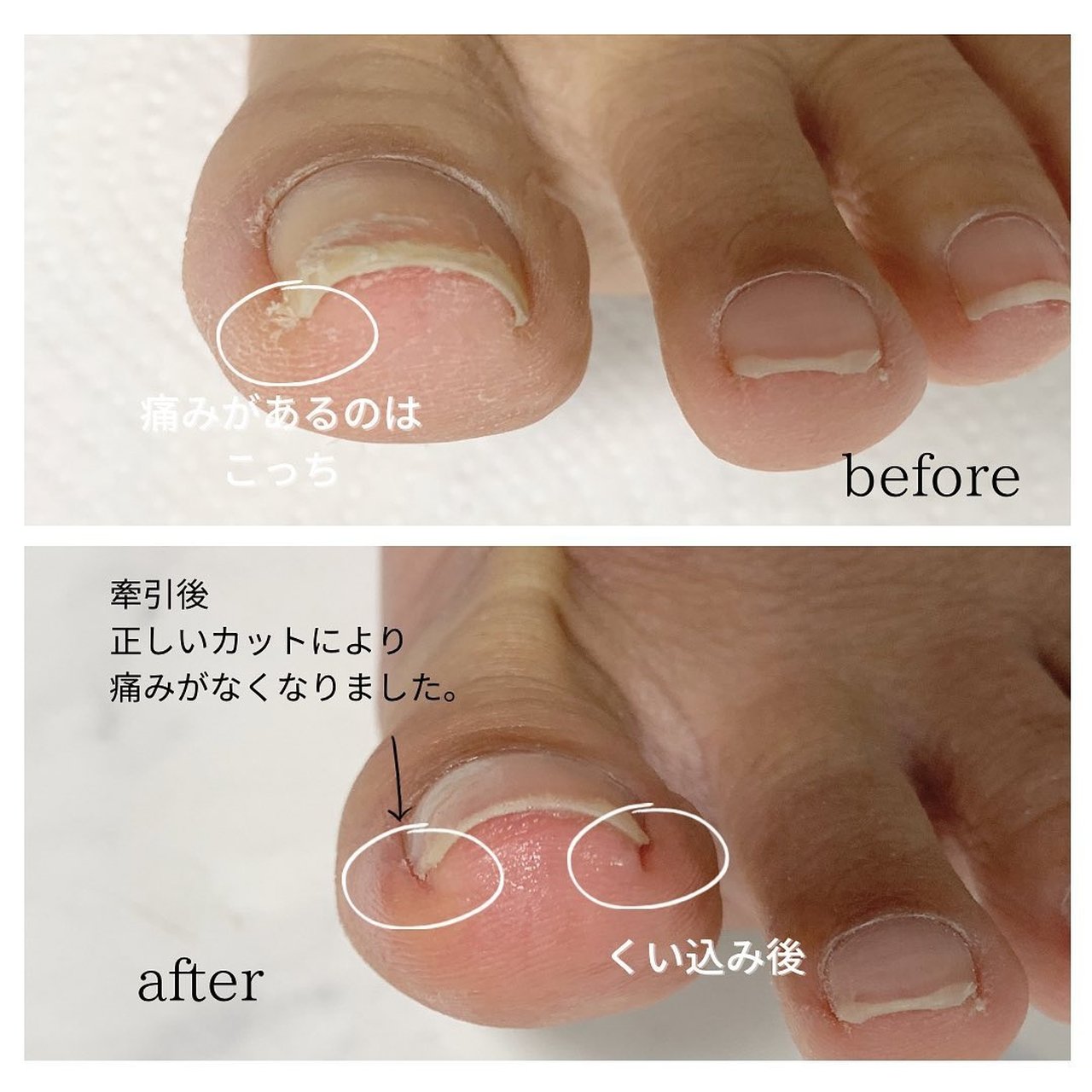 オールシーズン フット ネイルモデル Eriのネイルデザイン No ネイルブック