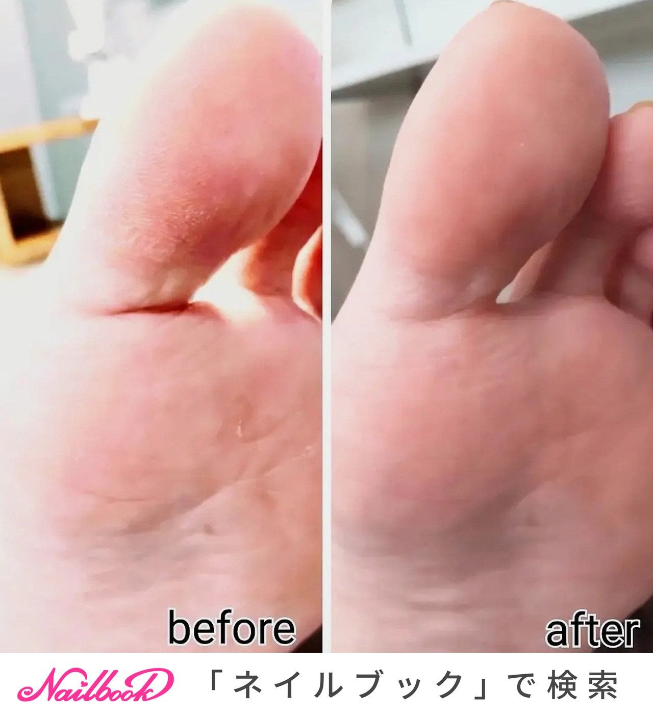 22年 新着順 ペディキュア アラフォーのネイルデザイン ネイルブック