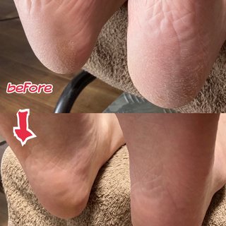 足裏角質除去のネイルデザイン ネイルブック