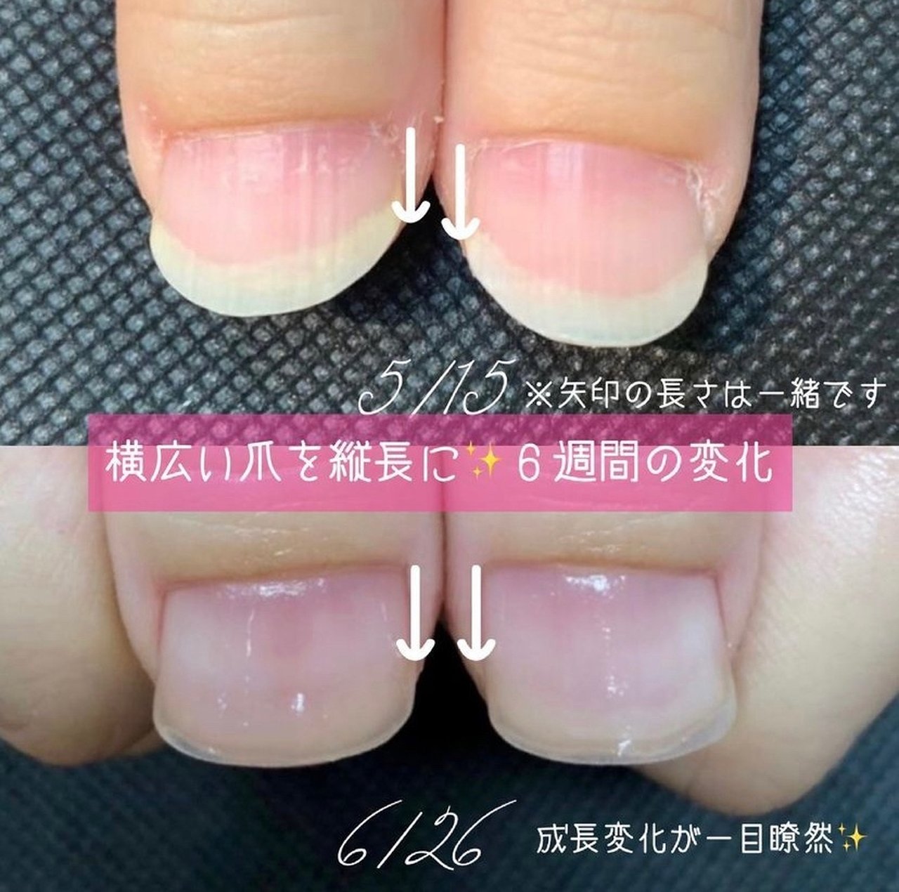 Eclat Nail1001のネイルデザイン No ネイルブック