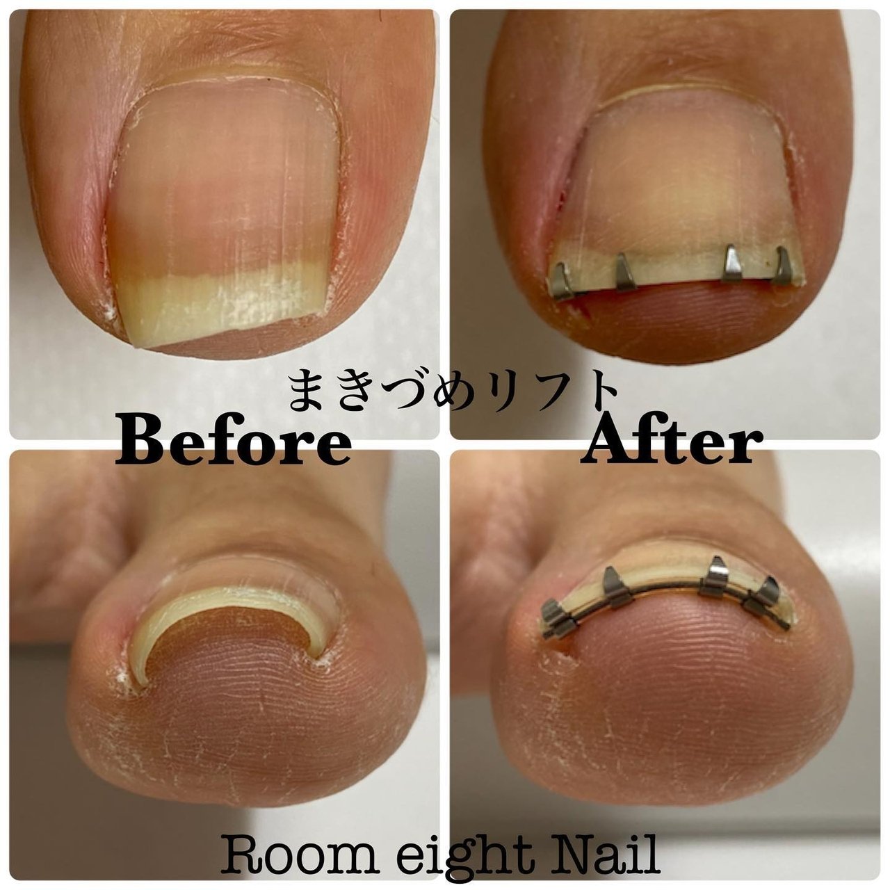春 夏 秋 冬 フット Room Eight Nailのネイルデザイン No ネイルブック
