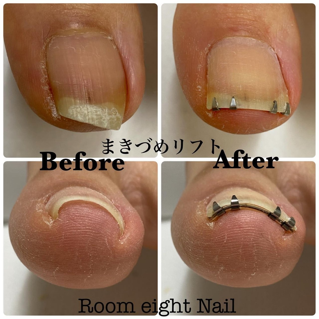春 夏 秋 冬 フット Room Eight Nailのネイルデザイン No ネイルブック