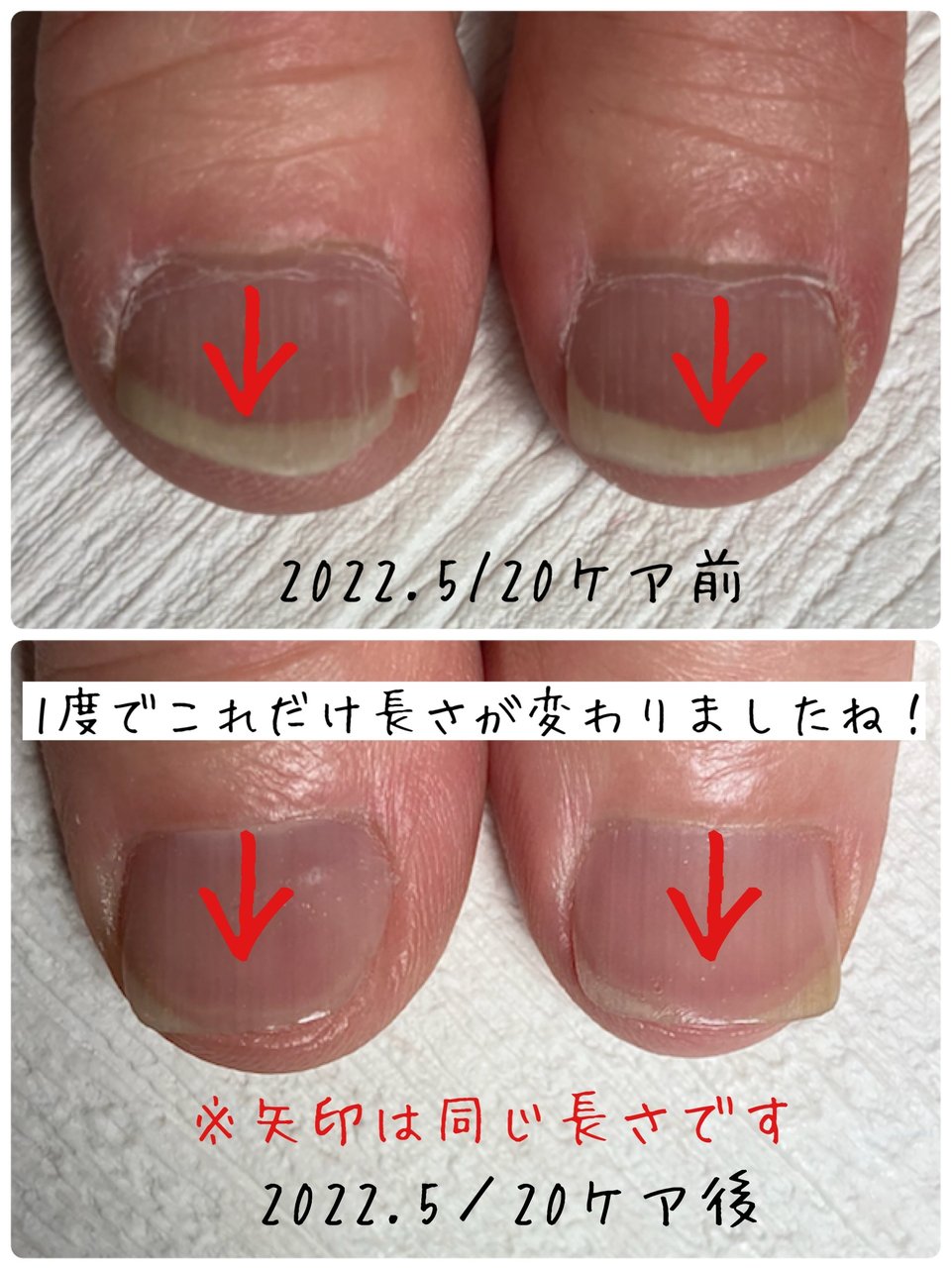 横浜市 泉区 緑園都市 ネイルサロン ネイルズギフト 尾山奈津子のネイルデザイン No 737 ネイルブック