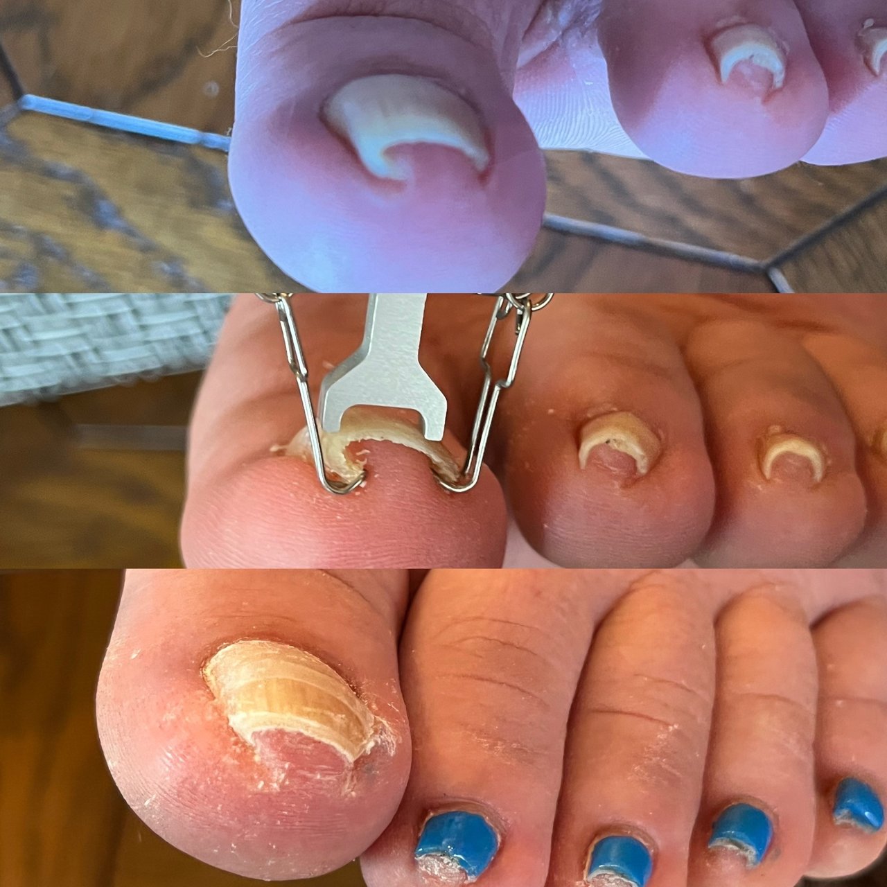 フット Hinya121のネイルデザイン No ネイルブック