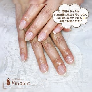 爪のコンプレックスのネイルデザイン ネイルブック