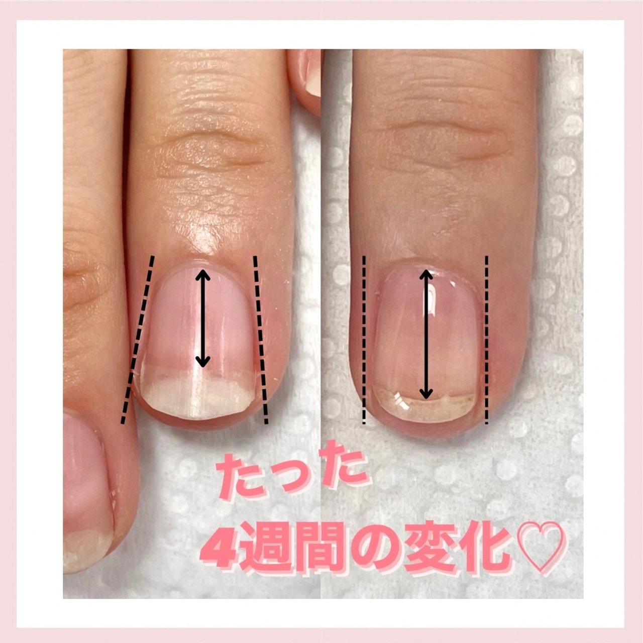 ハンド ショート ラウンド お客様 Hanaeのネイルデザイン No ネイルブック