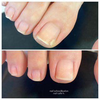 ネイルリペアのネイルデザイン ネイルブック