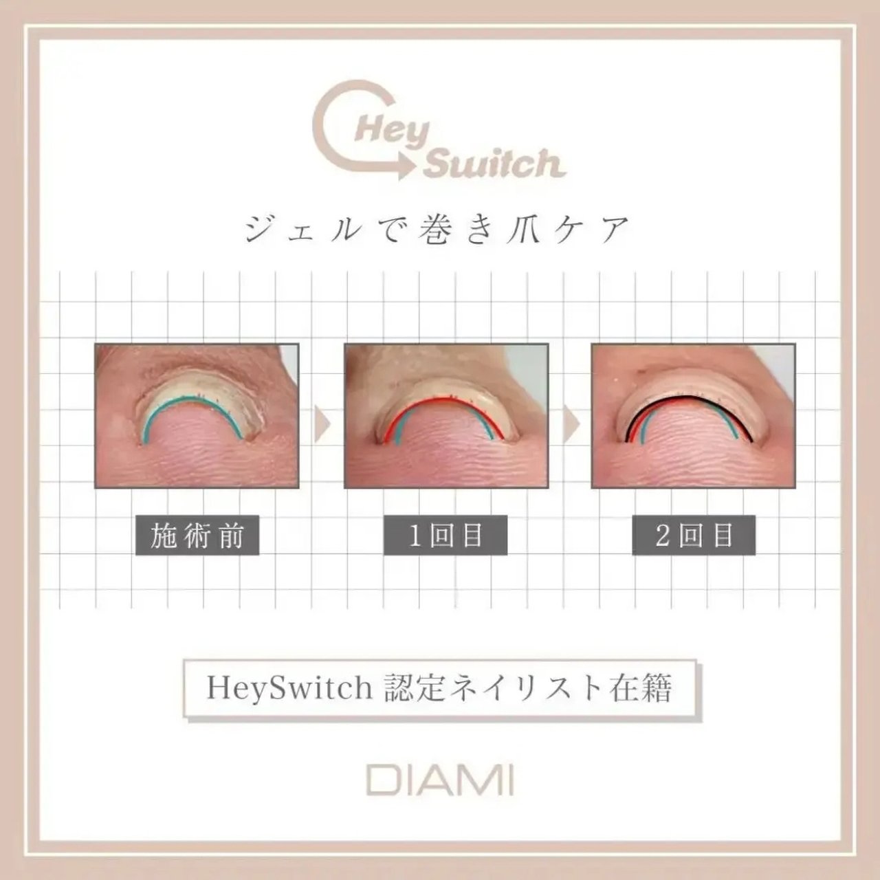 Hey Switch ヘイスイッチ ネイルカバーピンクジェル HeySwitch ネイルパワージェル | HeySwitch | ネイル用品