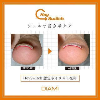 ヘイスイッチ　Heyswitch 新品未使用　巻き爪ケア　ベース＆トップ　正規品 HeySwitch ジェル3本セット | Hey Switch | ネイル用品・ネイル