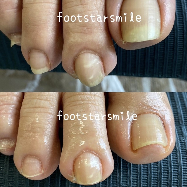 宮城仙台フットケアサロン＆訪問フットケアフットスタースマイル｜長