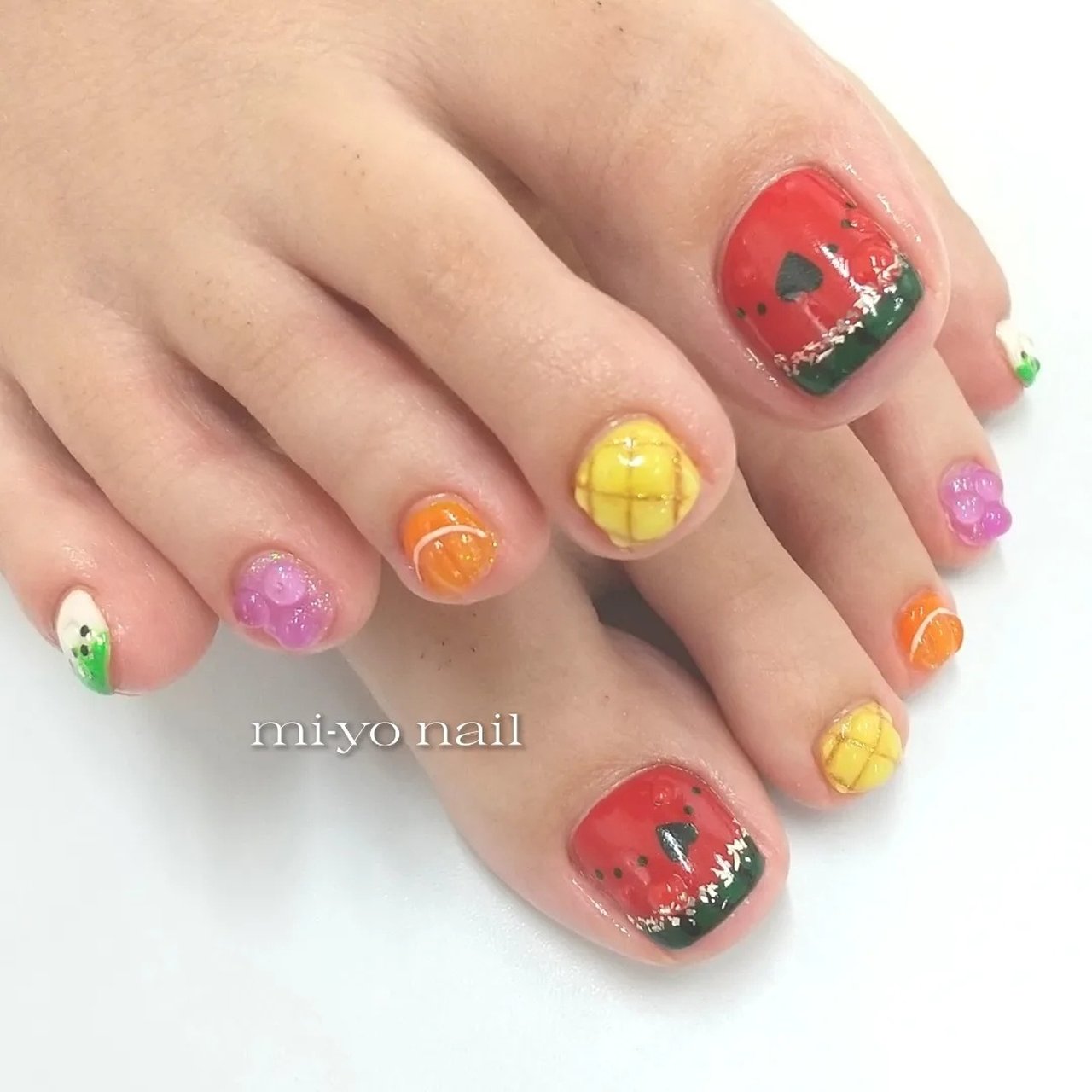 親指ペディチップ　ぷっくりフルーツ　夏　うるうる 親指ペディチップ ぷっくりフルーツ 夏 うるうる 【公式通販】
