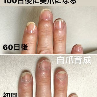 爪折れたのネイルデザイン｜ネイルブック