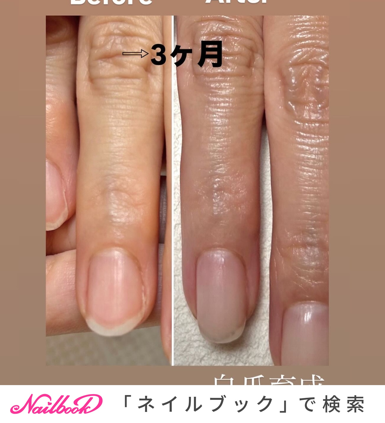 爪折れたのネイルデザイン｜ネイルブック