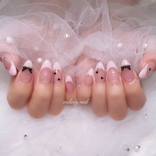 76))ワンホンネイル フレンチガーリー 埋めつくし 派手ネイル ピンクネイル 76))ワンホンネイル フレンチガーリー 埋めつくし 派手ネイル
