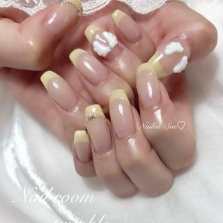 イエロー(黄)/量産型ネイルのネイルデザイン｜ネイルブック