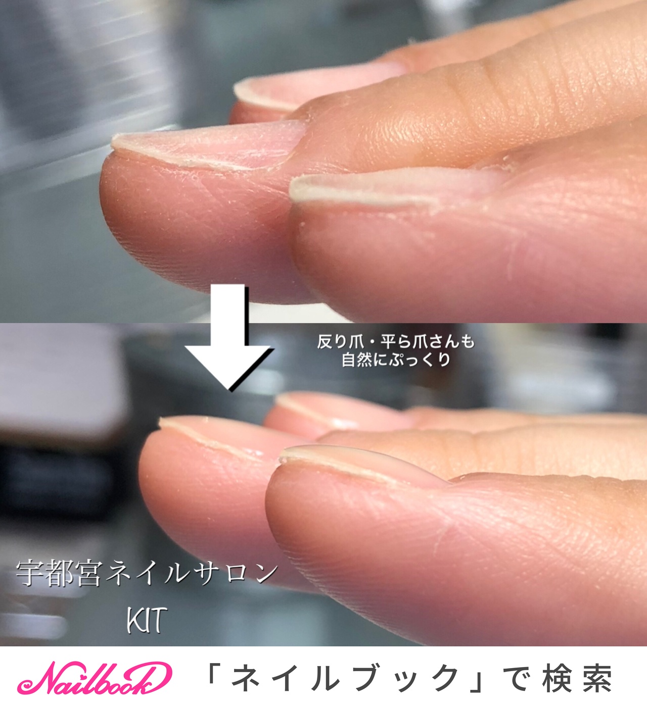 オールシーズン 成人式 卒業式 旅行 ハンド 宇都宮市 深爪専門 ネイルサロン キットのネイルデザイン No ネイルブック