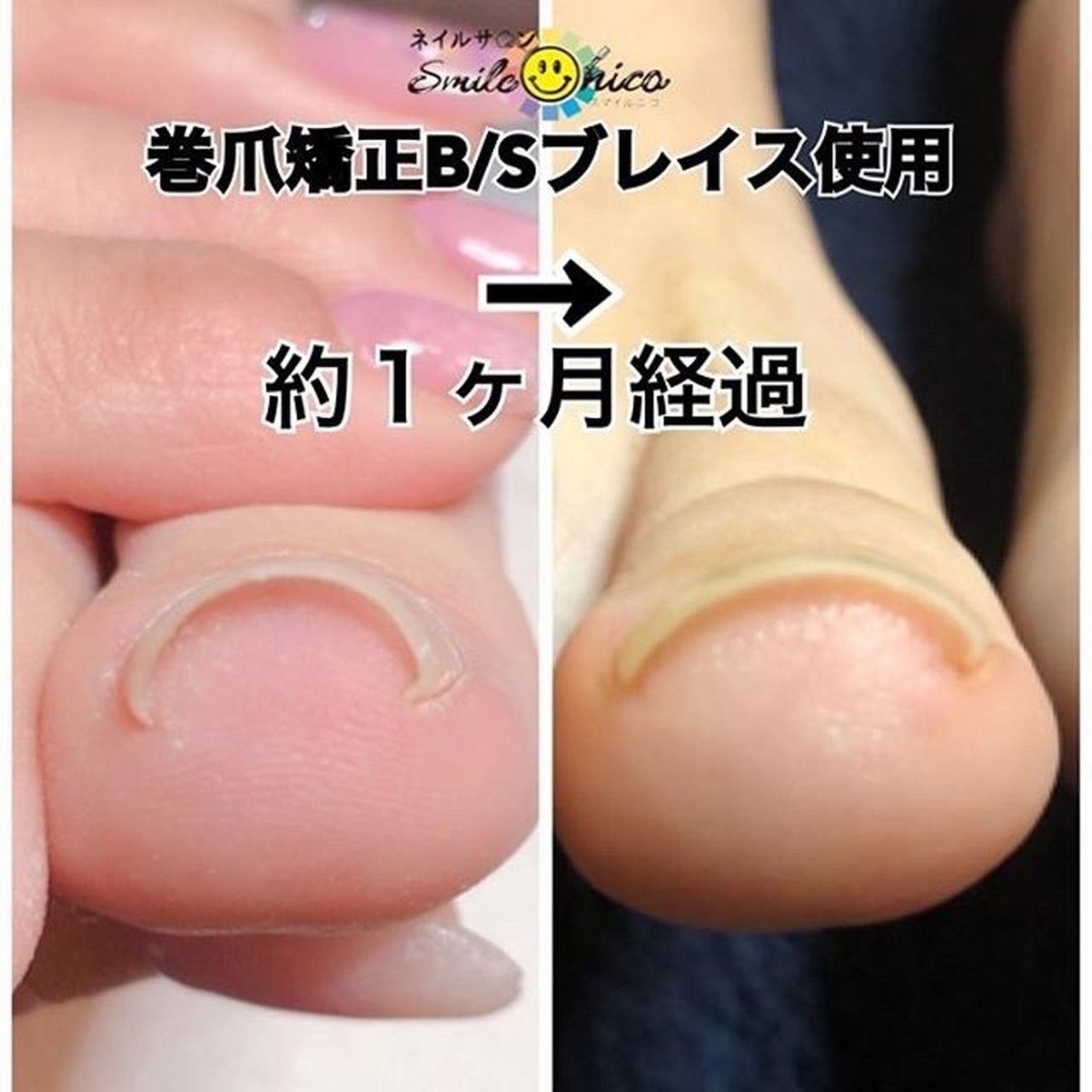 オールシーズン フット Smile Nico スマイルニコのネイルデザイン No ネイルブック