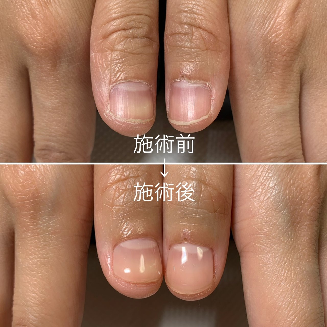 ハンド シンプル ショート クリア お客様 Nail Mekkoのネイルデザイン No ネイルブック