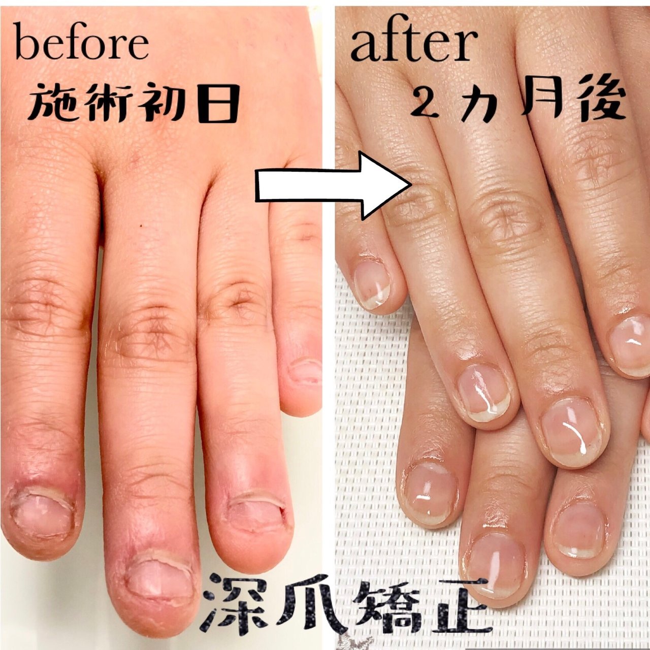 オールシーズン ハンド シンプル ショート クリア Crystal R Nail Salon のネイルデザイン No ネイル ブック