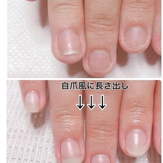 深爪矯正3回目のネイルデザイン ネイルブック