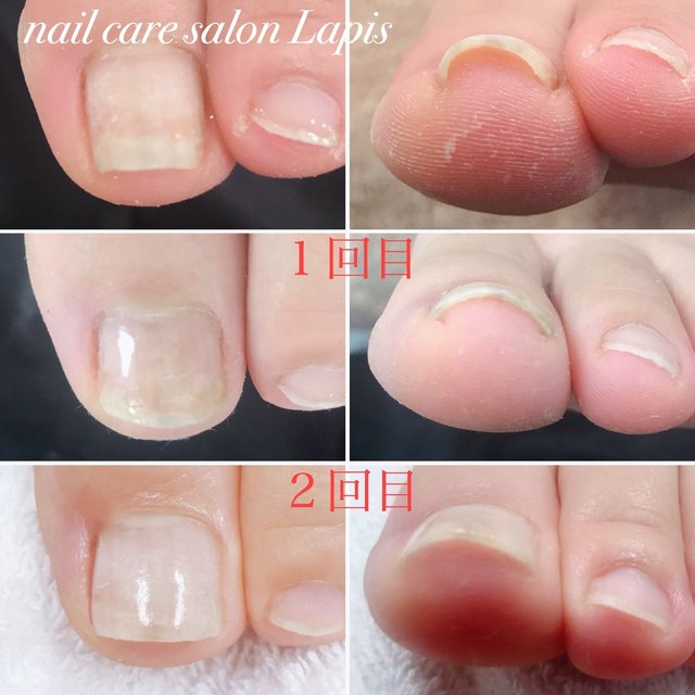 自爪育成 Nail Care Salon Lapis 厚木のネイルサロン ネイルブック