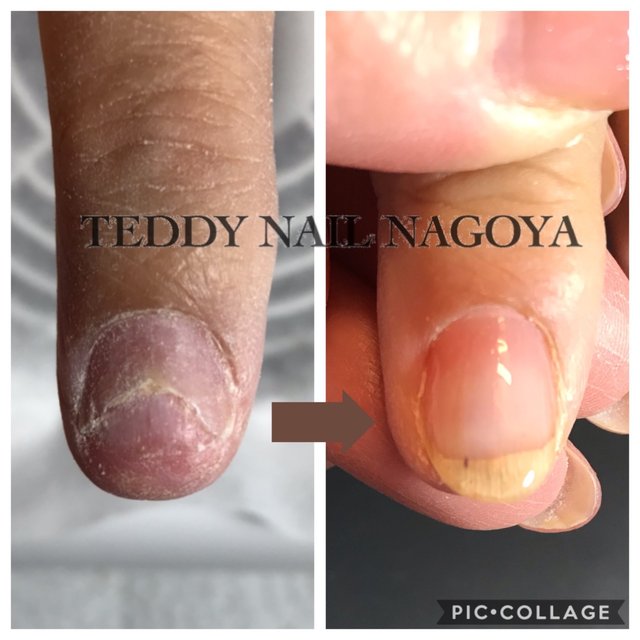 覚王山ネイルサロン テディネイル名古屋 Teddy Nail Nagoya 覚王山のネイルサロン ネイルブック