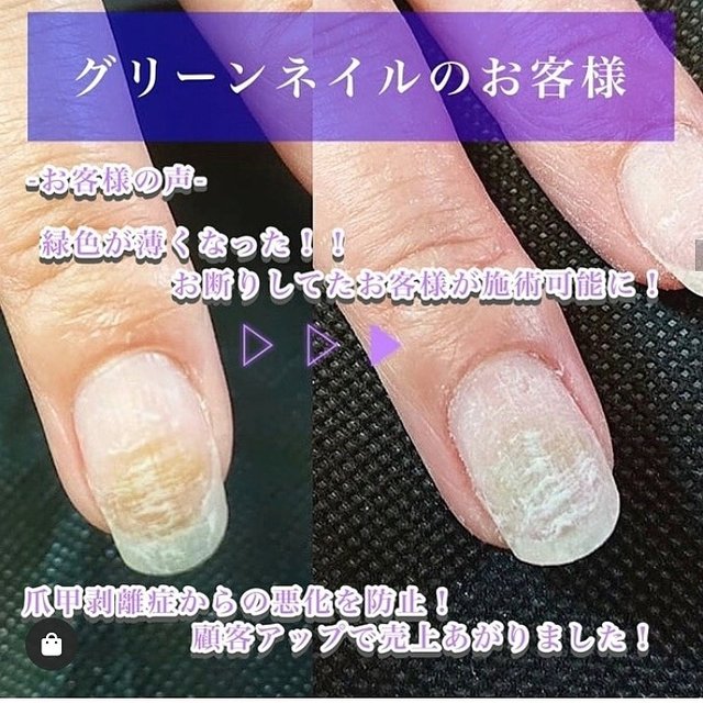 Shuacoco Nail Eye 前栽のネイルサロン ネイルブック