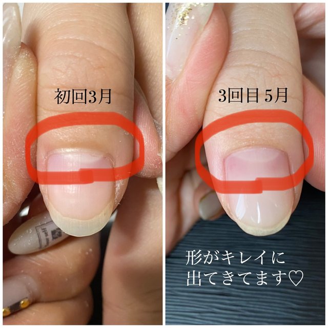 Amuree Nail アムリーネイル 住吉のネイルサロン ネイルブック