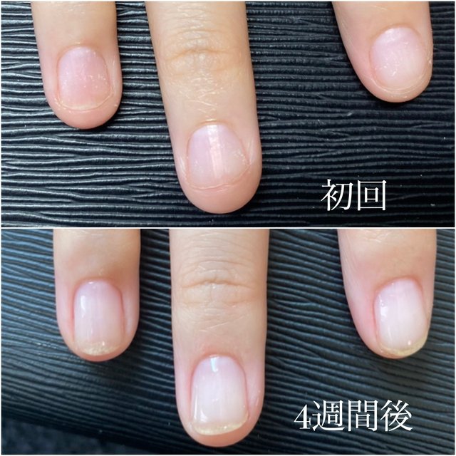 Amuree Nail アムリーネイル 住吉のネイルサロン ネイルブック