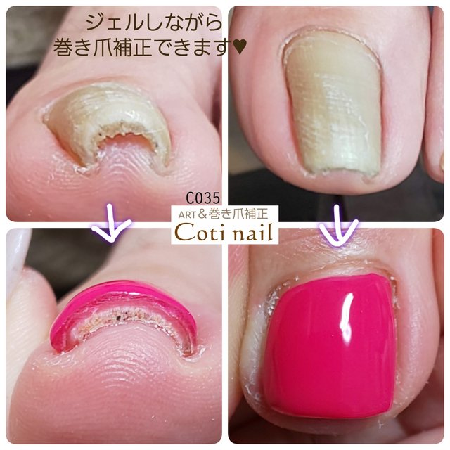 お悩み相談室 Coti Nail コチネイル 府中のネイルサロン ネイルブック