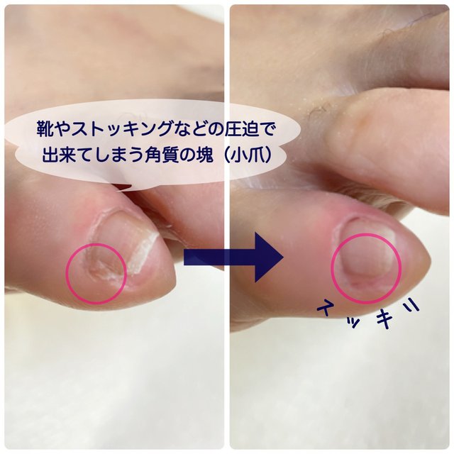 Panco Nail パンコネイル 与野のネイルサロン ネイルブック