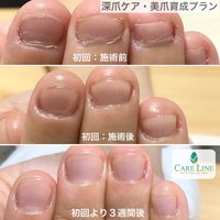 熊谷駅の安いネイルサロン ネイルブック