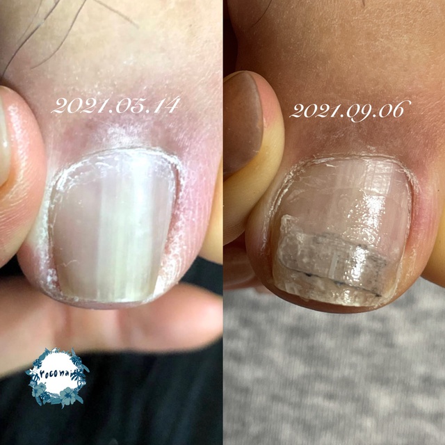 鎌ヶ谷市ネイルサロン Roconail ロコネイル 新鎌ヶ谷のネイルサロン ネイルブック