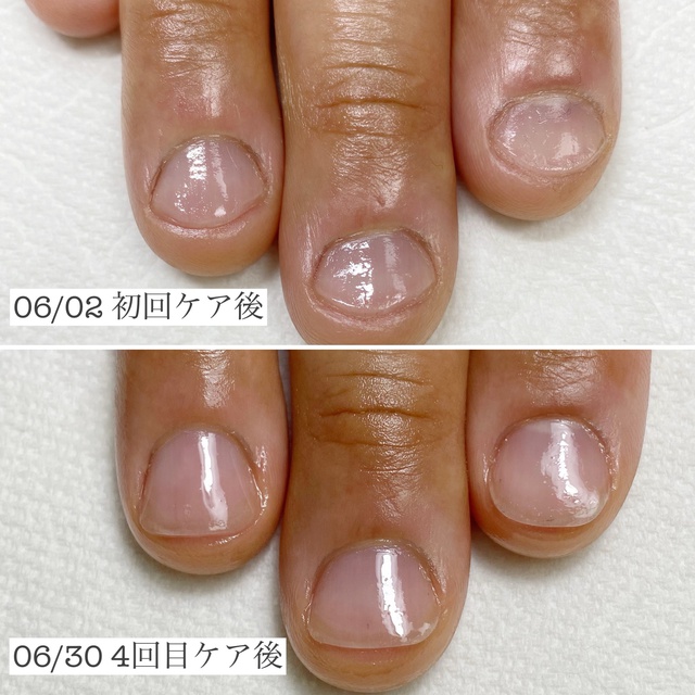 Nail Room Regalo パラジェル登録店 手の病院サロン導入店 香里園のネイルサロン ネイルブック