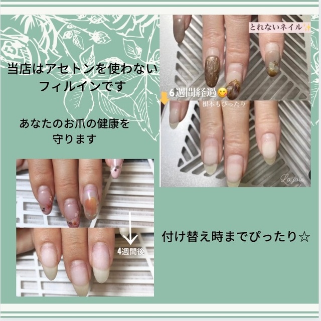 巻き爪ケア と 取れないネイル の La Joie Private Nailsalon 味美 名鉄 のネイルサロン ネイルブック