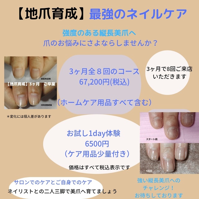 巻き爪・育爪 ネイル&ネイルケア S-nail ＊エスネイル ＊｜三島のネイルサロン｜ネイルブック