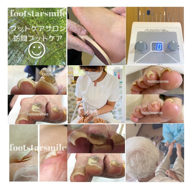 宮城仙台フットケアサロン＆訪問フットケアフットスタースマイル｜長