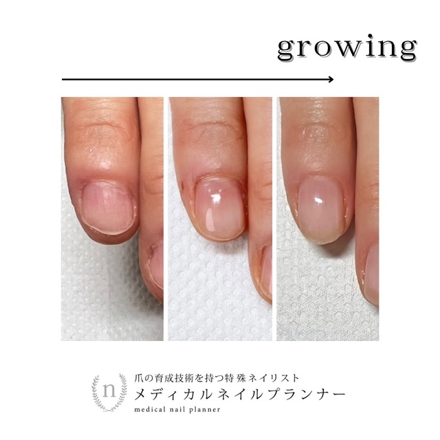 gemickle nail｜瑞江のネイルサロン｜ネイルブック