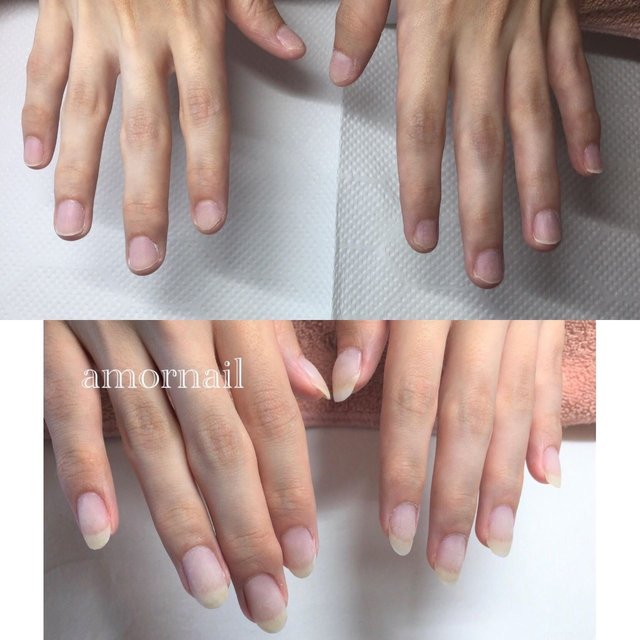 深爪改善できるネイルサロン 辻堂西口徒歩1分 Amornail アモールネイル 辻堂のネイルサロン ネイルブック