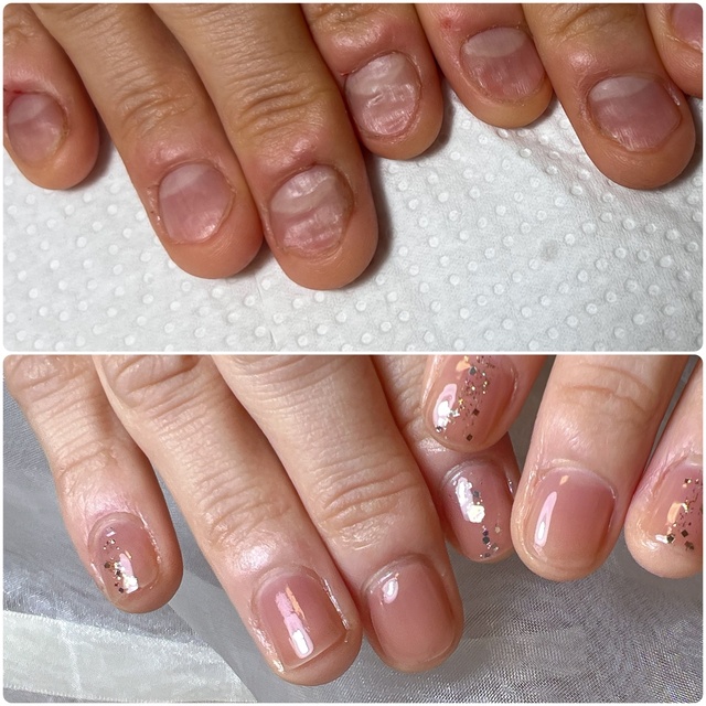 京都【Rio】 | 深爪改善｜丁寧な施術｜西山天王山のネイルサロン