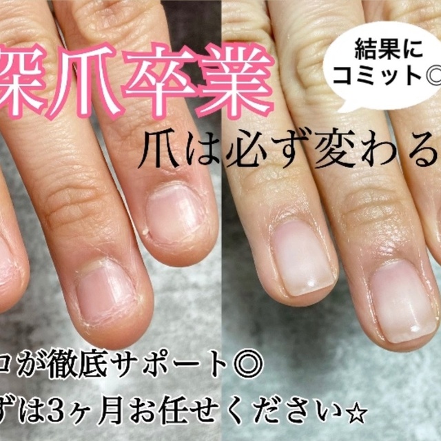 深爪改善・自爪育成サロンk.nail｜俊徳道のネイルサロン｜ネイルブック