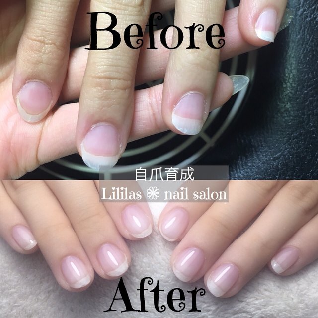 Lililas Nail Salon School お爪のトラブルケア 整形級ネイル 甚目寺のネイルサロン ネイルブック