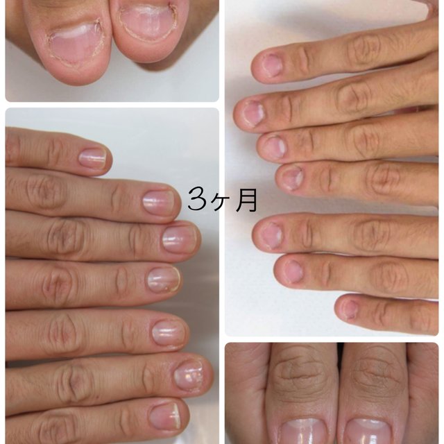 Ailab Nail アイラボネイル 黒部のネイルサロン ネイルブック