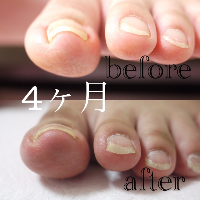 Nailsalon Shacty シャクティ 山科のネイルサロン ネイルブック